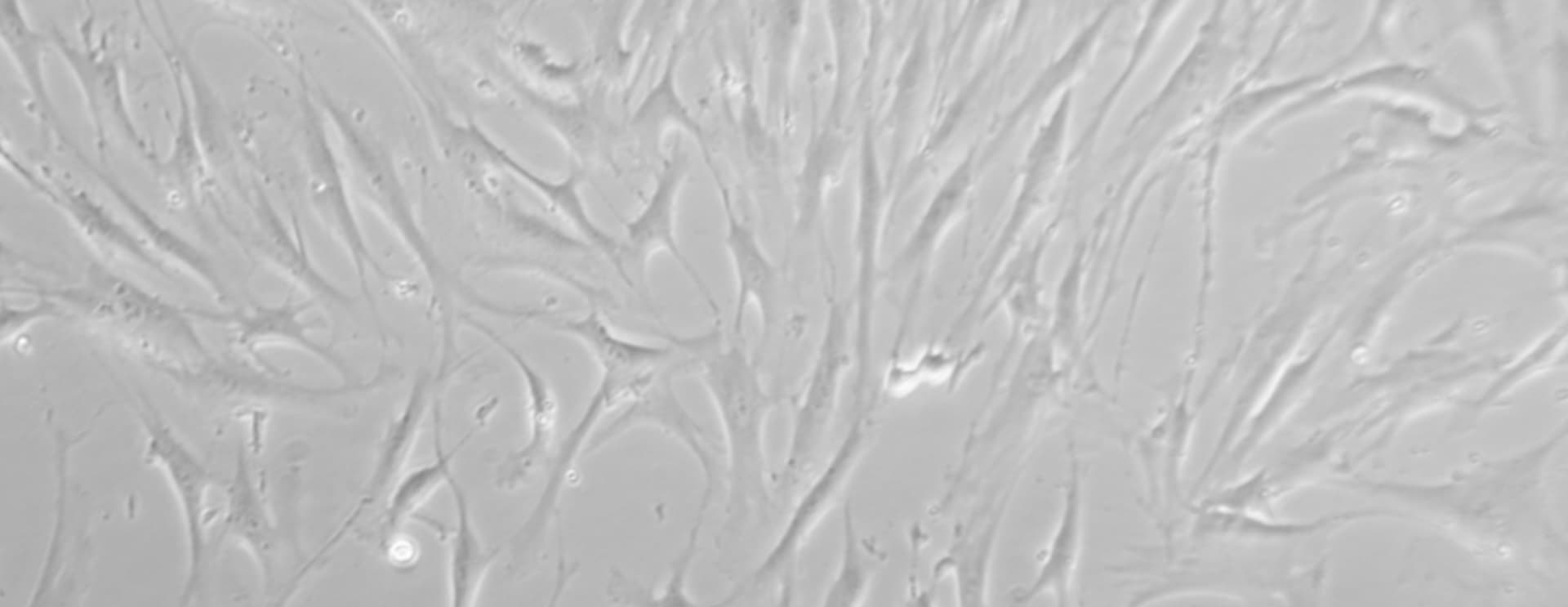 Example of expanded stem cells under microscope - a cellfie