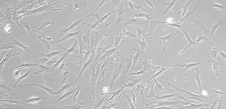 Store your stem cells